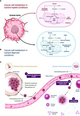 Metabolic and senescence characteristics associated with the immune microenvironment in ovarian cancer